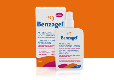 try review benzagel after care moisturizing lotion